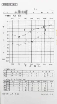 突発性難聴｜発症時