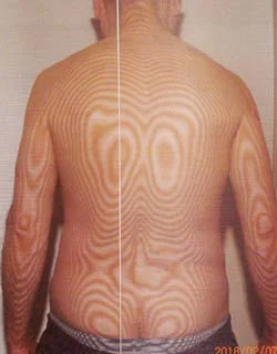 耳硬化症症｜重心が歪んだ体（治療前）