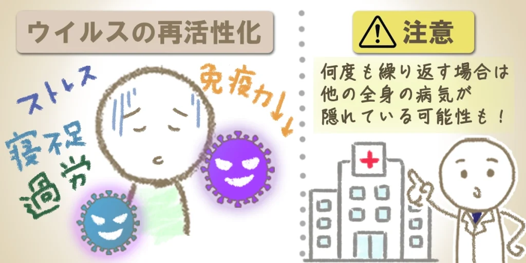 ストレスなどにより免疫力が低下し、体の中に潜んでいたウイルスが再活性化する様子と、何度も繰り返す場合の注意喚起のイラスト