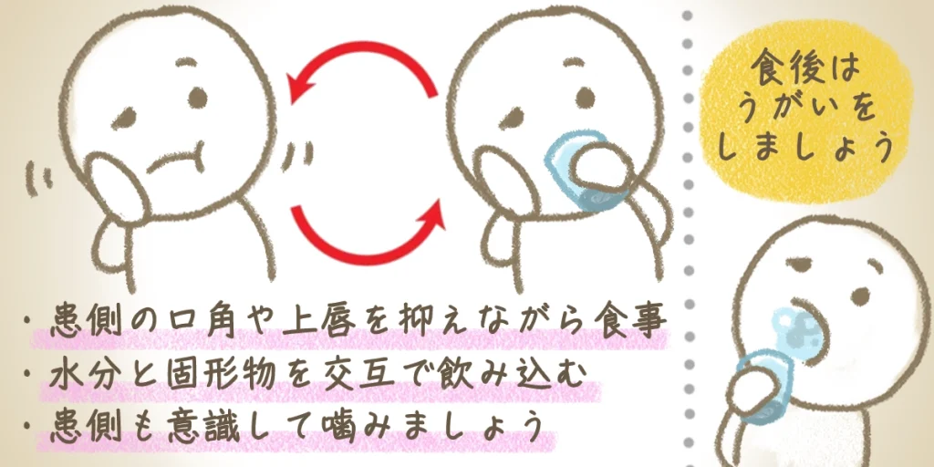 顔面神経麻痺の食事のときの対処法のイラスト